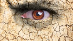 5 признака на дехидратация