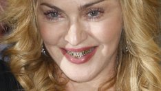 Едни от най-скъпите усмивки на шоубизнеса