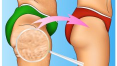 4 храни срещу целулит