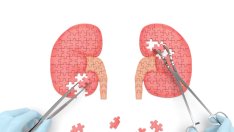 3 полезни билки, пречистващи бъбреците