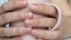 Признаци на бъбречни проблеми, които ноктите издават 