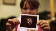 3D ултразвук позволява на родителите да видят бъдещото бебе в цветове