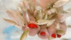 Терапия с рибки помага при много кожни проблеми