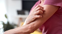 5 неочаквани признака, че здравето на червата е влошено