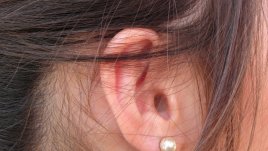 Билки помагат при себореен дерматит 