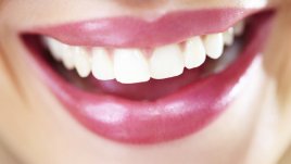 5 лесни трика за избелване на зъбите