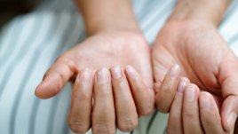 Скрити здравословни проблеми, които предизвикват промени в ноктите 