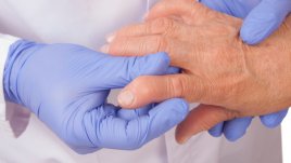 Храни, полезни при артрит