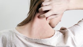 Безплатни прегледи във ВМА за псориазис