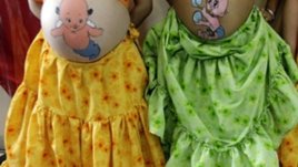 Преяждането и недохранването са еднакво вредни при бременност