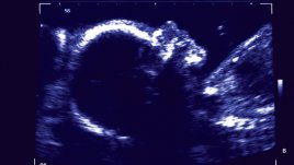 Изумителни неща, които бебето ви прави в корема