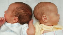 Какво представлява фето-феталният трансфузионен синдром?