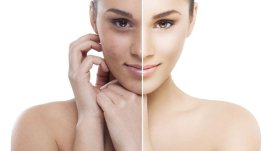 Премахнете хиперпигментацията лесно у дома
