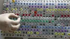 НЗОК ще плаща скенер и инвитро процедурите през 2013