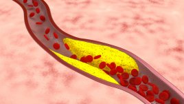 Симптоми, подсказващи за артериални проблеми