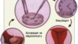 In Vitro или Бебе в епруветка