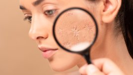 Различните белези изискват различно лечение, категорична е д-р Бан Камуна