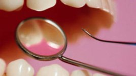 Ходим на зъболекар, ако ни подсетят