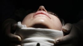 Задължителен психотест преди пластична операция