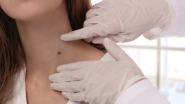 Безплатни прегледи при дерматолозите на ВМА