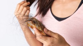 Косопад при жените: 4 причини, които да имате предвид