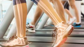 Как да се погрижим за здравето на костите