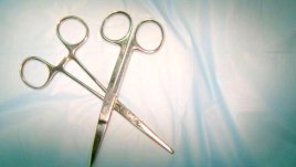 Спасиха жена с 5 тумора в главата