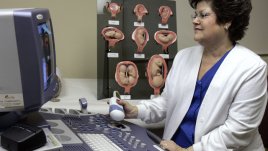 Кървене по време на овулация