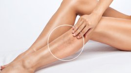 Рискови фактори за хроничната венозна болест 