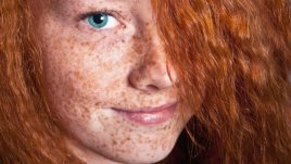 Как да се отървем от досадните лунички по кожата?