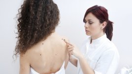 Какво ни излага на риск от поява на рак на кожата?