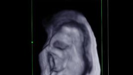 4 строги предписания как бременните да се къпят във вана