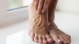 5 важни упражнения при разширени вени