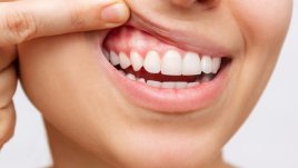 Как да спрете стискането на зъби през нощта