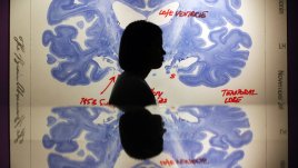 Няколко съвета да се предпазим от Алцхаймер