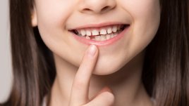 Стоматолог: Децата трябва да ходят на преглед 3-4 пъти на година