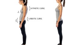 Симптоми, профилактика и лечение на хиперлордозата