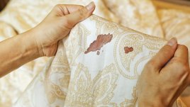 Как най-лесно да изперете петно от кръв?