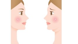 Как да премахнете двойната брадичка