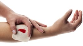 Натурални лекове при порезни рани и ожулвания