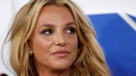 Холивудски знаменитости с пластични корекции 