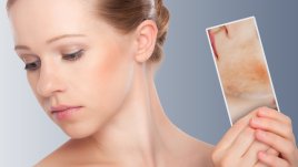 Натурално премахване на хиперпигментация по лицето 