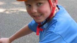 Как да се справим с грозните синини?