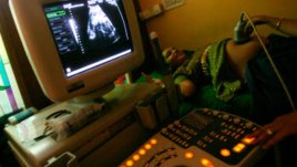 Синдром на Даун – рискова възраст, причини, изследвания