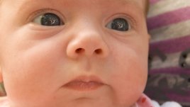 Хемангиом при децата – решенията