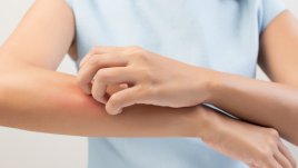 За какво подсказва екземата ви?