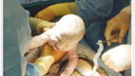 Как предпочитате да родите?