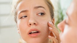 Какво причинява сухата кожа