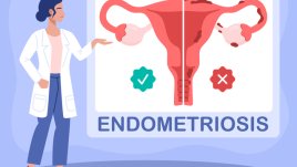 Безплатни прегледи за ендометриоза през март