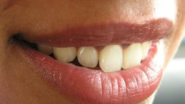 Развалените зъби крият риск за сърцето